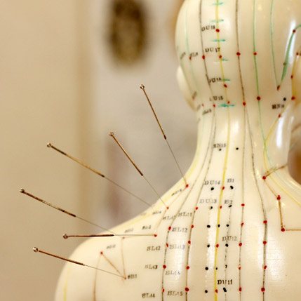 TCM Acupuncture